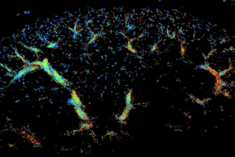 Imagen captada por escáner 