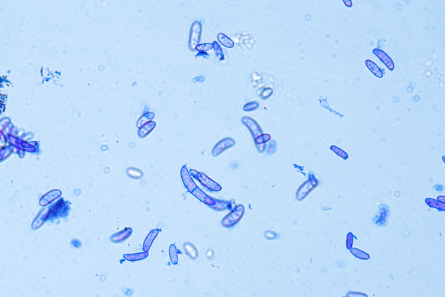 Imagen microscópica teñida de azul en la que se observan numerosas células pequeñas de forma ovalada dispersas sobre un fondo claro.
