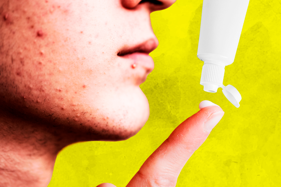 Persona con pasta de dientes en su índice.